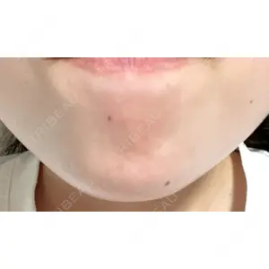 フィラークリニック フィラークリニック 町田院口コミ