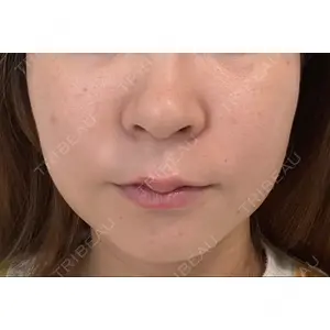 AI Beauty Clinic （エーアイ美容クリニック）口コミ