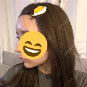 APスキンクリニック銀座口コミ