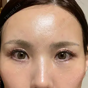 X CLINIC X CLINIC 銀座院口コミ
