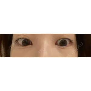 東京イセアクリニック口コミ