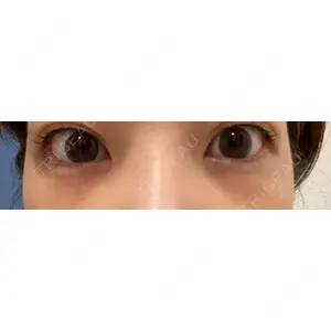 東京イセアクリニック口コミ