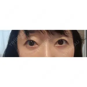 TCB東京中央美容外科 TCB東京中央美容外科 倉敷院口コミ