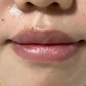 B-LINE CLINIC B-LINE CLINIC 池袋院口コミ