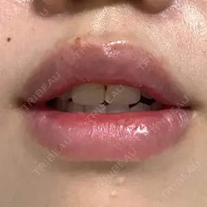 B-LINE CLINIC B-LINE CLINIC 池袋院口コミ