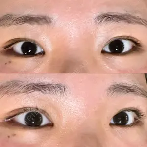 HAAB×DREAM BEAUTY CLINIC HAAB×DREAM BEAUTY CLINIC 大阪梅田院口コミ