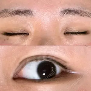 HAAB×DREAM BEAUTY CLINIC HAAB×DREAM BEAUTY CLINIC 大阪梅田院口コミ
