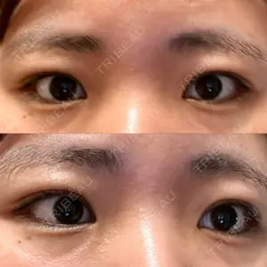 HAAB×DREAM BEAUTY CLINIC HAAB×DREAM BEAUTY CLINIC 大阪梅田院口コミ