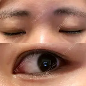 HAAB×DREAM BEAUTY CLINIC HAAB×DREAM BEAUTY CLINIC 大阪梅田院口コミ