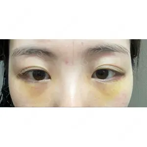 APOLLO BEAUTY CLINIC口コミ