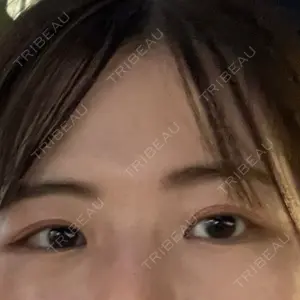 APOLLO BEAUTY CLINIC口コミ