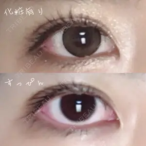 大塚美容形成外科 大塚美容形成外科 横浜院口コミ