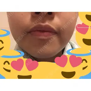 口コミ
