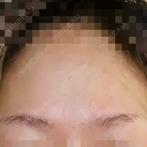 TCB東京中央美容外科 TCB東京中央美容外科 新宿東口院口コミ