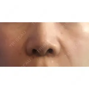 ビューティースキンクリニック ビューティースキンクリニック 新宿院口コミ