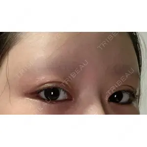POP美容整形クリニック口コミ