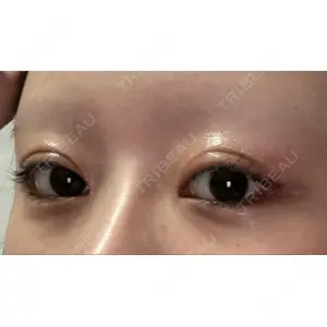 POP美容整形クリニック口コミ