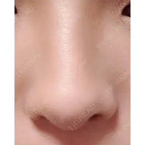 口コミ