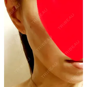 X CLINIC X CLINIC 恵比寿院口コミ