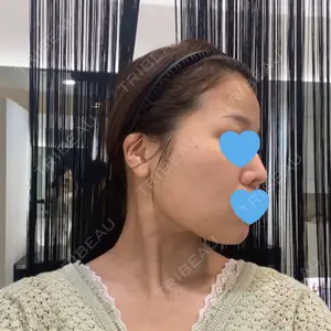 口コミ
