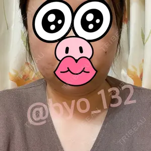 口コミ