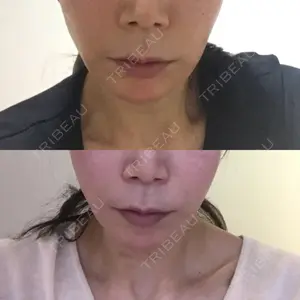 口コミ