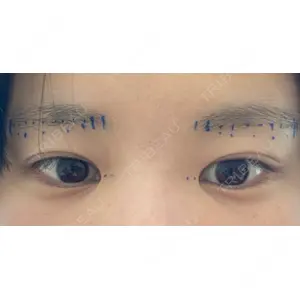Zetith Beauty Clinic Zetith Beauty Clinic 銀座院口コミ