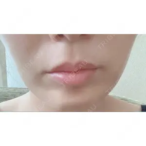 口コミ
