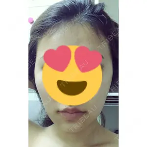 ボンディ美容整形外科（旧リオン整形外科）口コミ