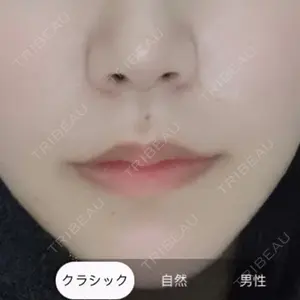 アネシス美容クリニック口コミ