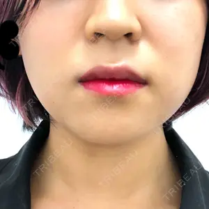 口コミ