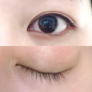 R.O.clinic口コミ