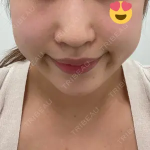 口コミ
