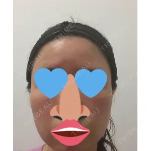 湘南美容クリニック 湘南美容クリニック 池袋西口院口コミ