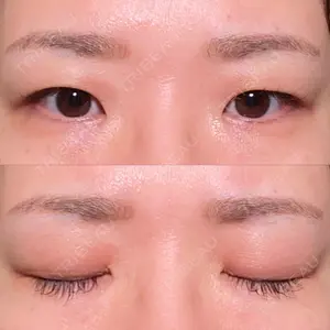 東京BELLEZZAクリニック口コミ
