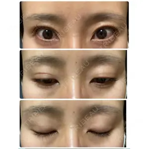 OZI SKIN CLINIC（オジスキンクリニック）口コミ