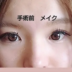 中央クリニック 大阪梅田中央クリニック美容外科口コミ