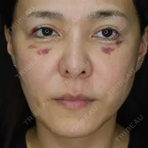 B-LINE CLINIC B-LINE CLINIC 池袋院口コミ