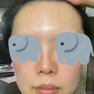 口コミ