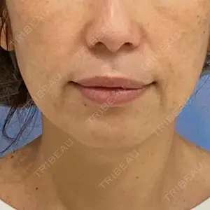 湘南美容クリニック 湘南美容クリニック 新宿本院口コミ