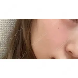 東京皮膚科・形成外科 東京皮膚科・形成外科 (銀座いけだクリニック)口コミ