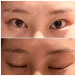 聖心美容クリニック グループ 聖心美容クリニック 六本木院口コミ