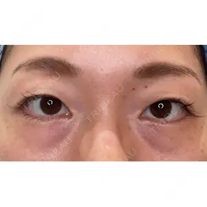 APOLLO BEAUTY CLINIC口コミ
