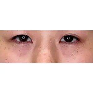 APOLLO BEAUTY CLINIC口コミ