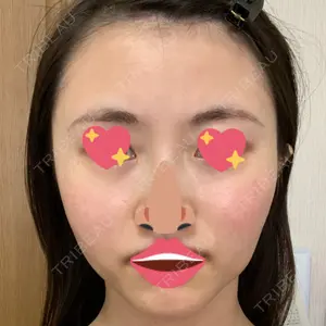 口コミ