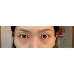 JBCジュノビューティークリニック 新宿三丁目院口コミ