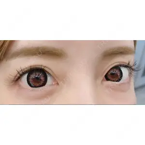 口コミ