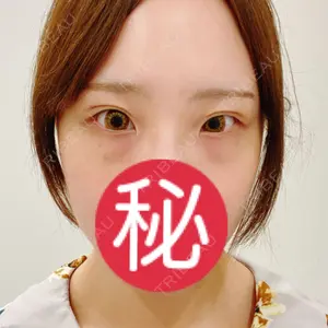 TCB東京中央美容外科 TCB東京中央美容外科 梅田茶屋町院口コミ