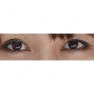 有楽町美容外科クリニック口コミ