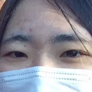 東京イセアクリニック口コミ